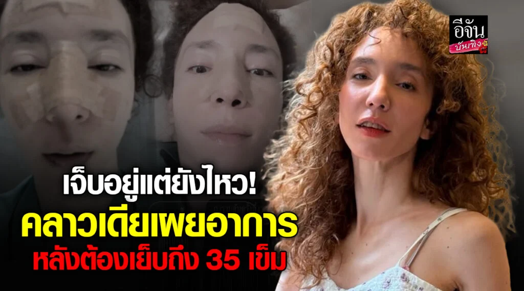 คลาวเดีย