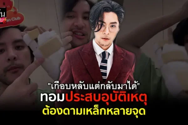 ทอม อิศรา เปิดใจหลังประสบอุบัติเหตุ สกู๊ตเตอร์ล้ม เจ็บหนักไปทั้งตัว ทอม อิศรา